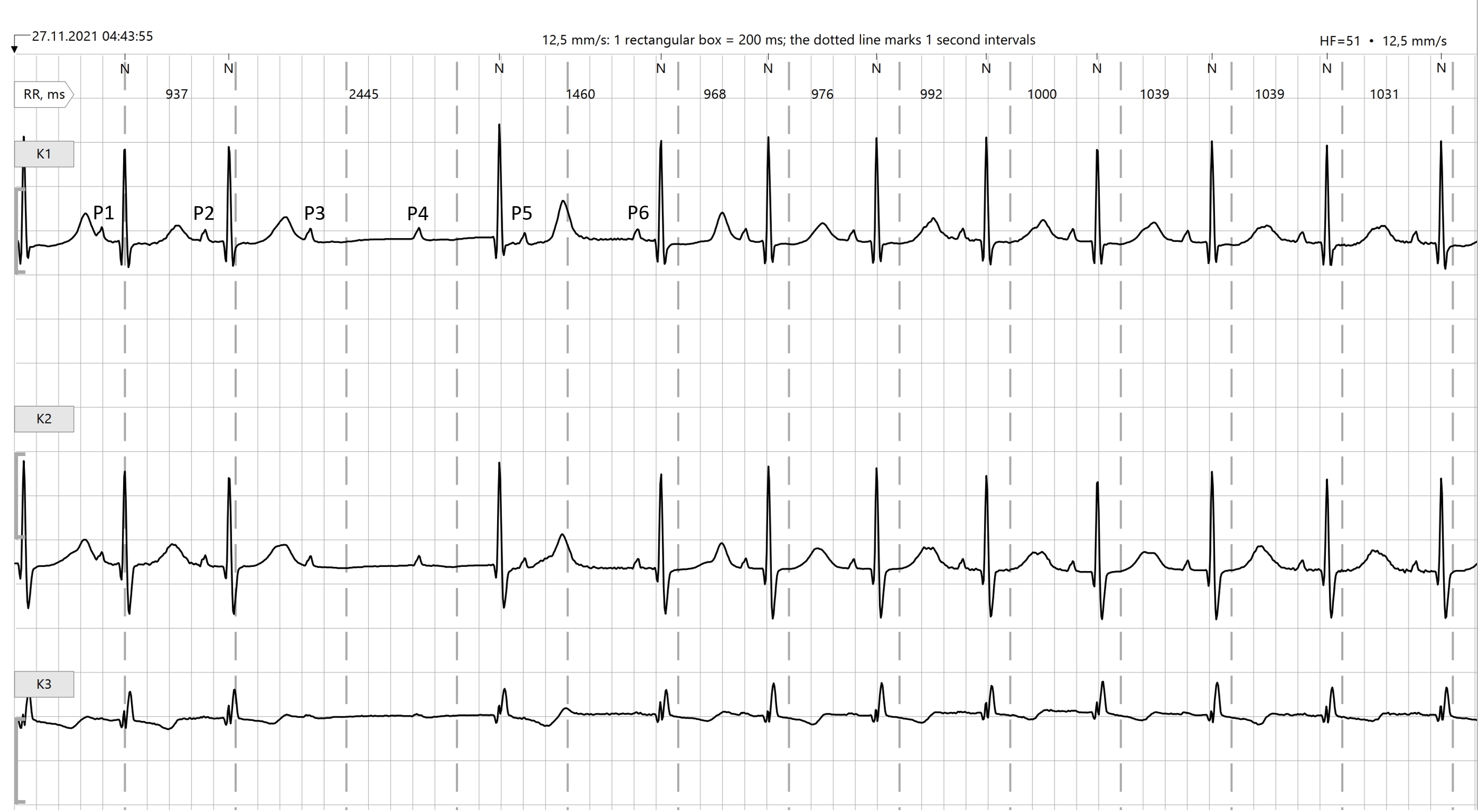 Rhythm strip ECG Guru Instructor Resources